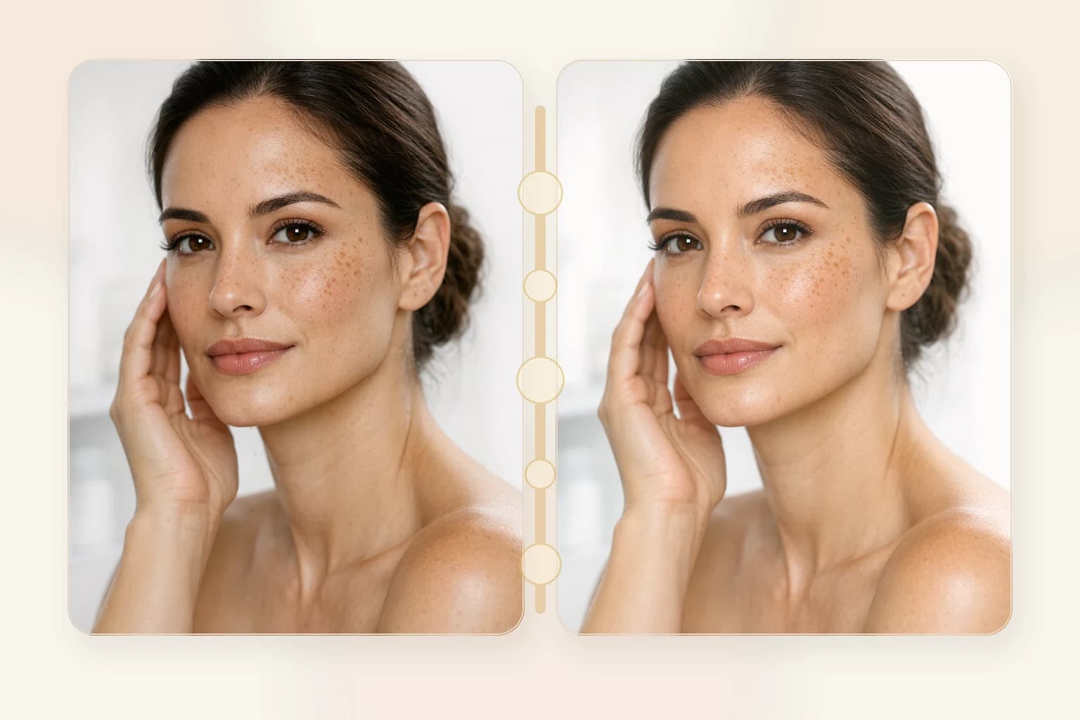 Chemical Peels at NPMD