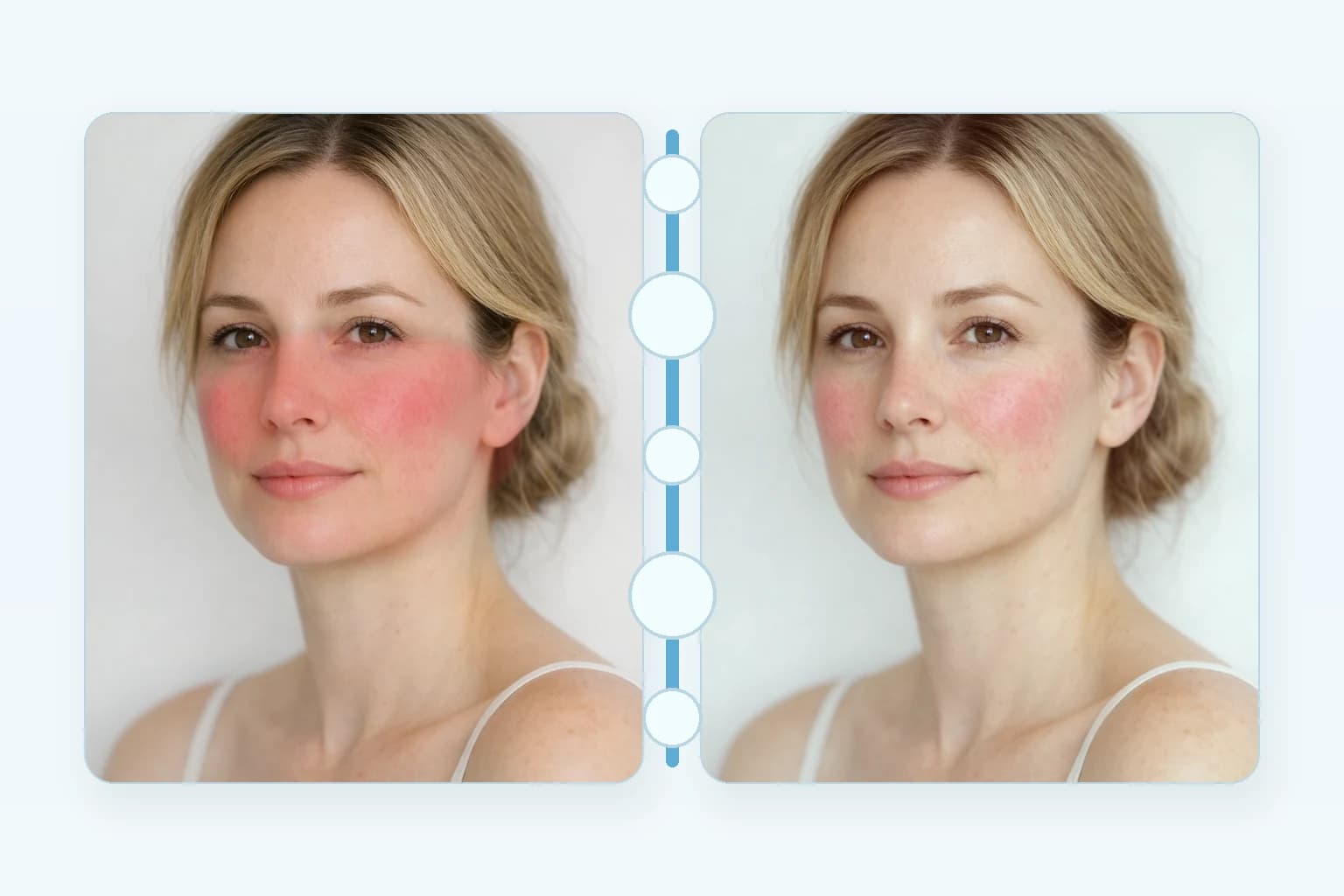 LED Light Therapy at NPMD