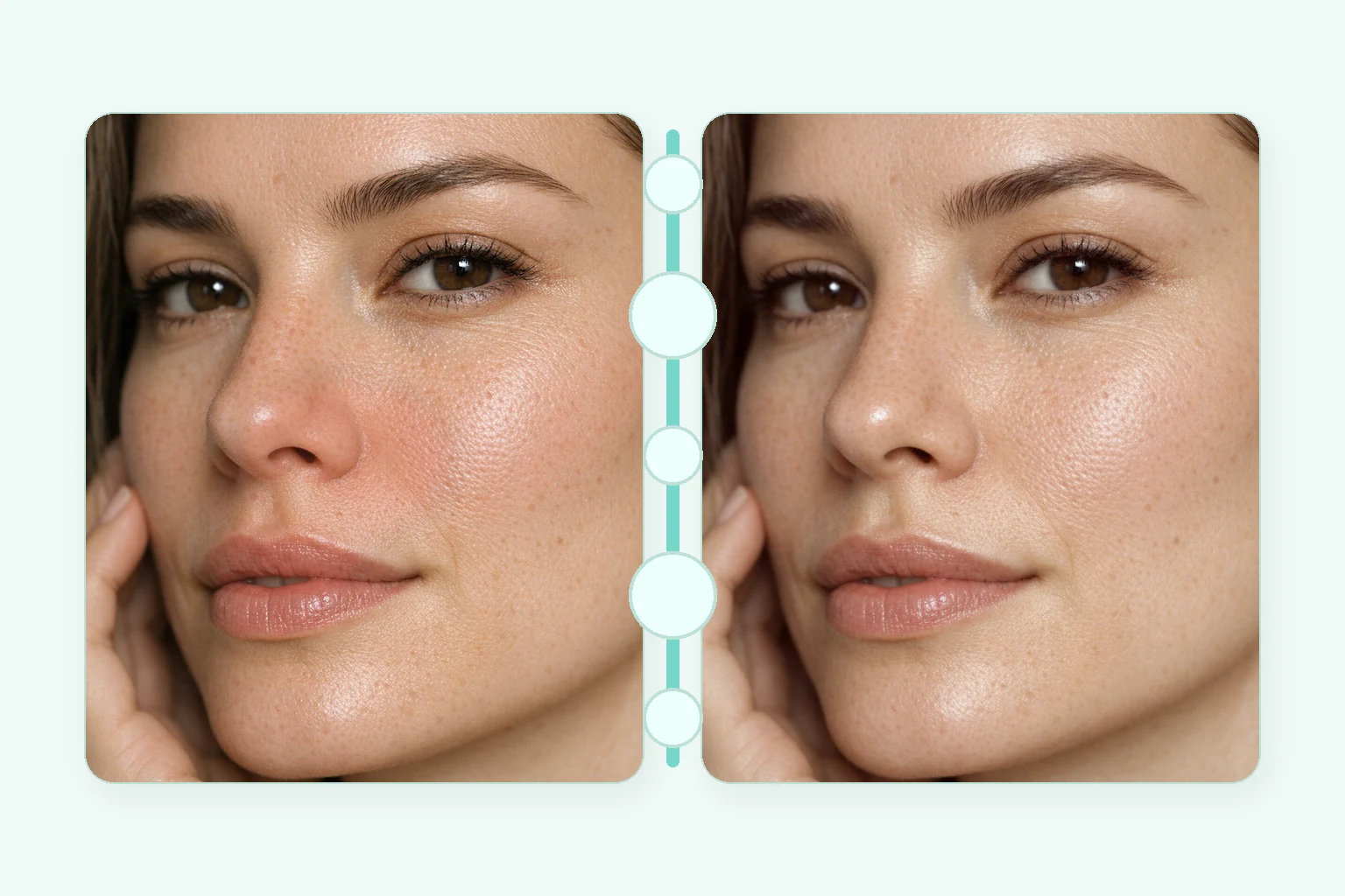 Illustrative before and after comparison for an Acne Clarifying Facial showing clearer-looking skin and less redness