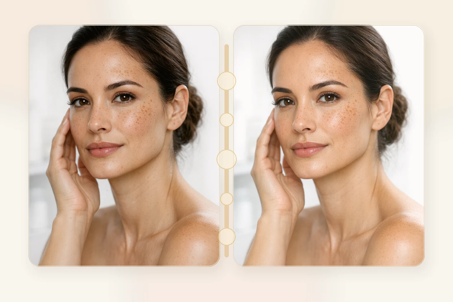 Illustrative before and after comparison for chemical peels showing brighter tone and reduced discoloration