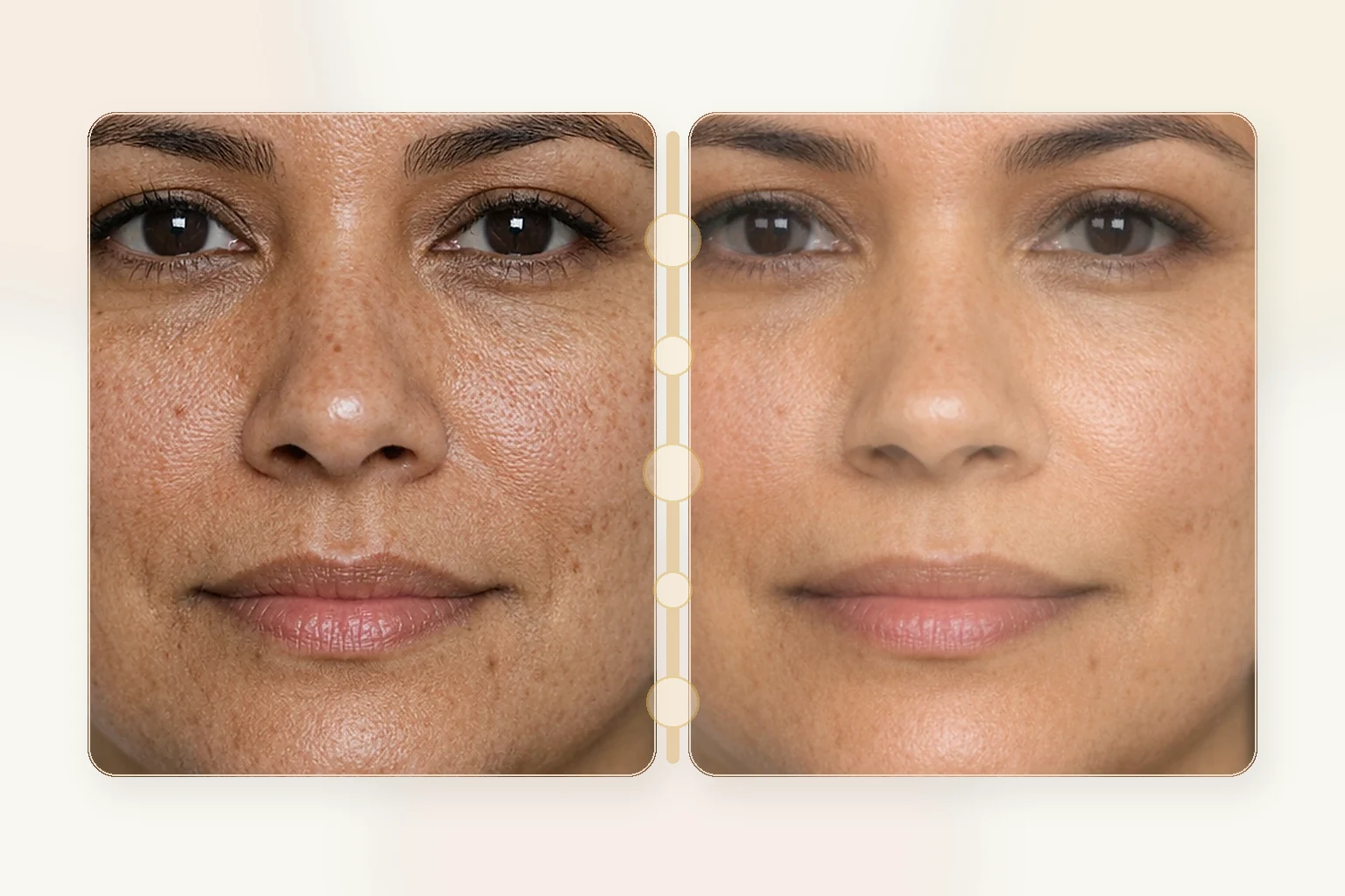 Illustrative close texture comparison after chemical peels for smoother skin and less discoloration