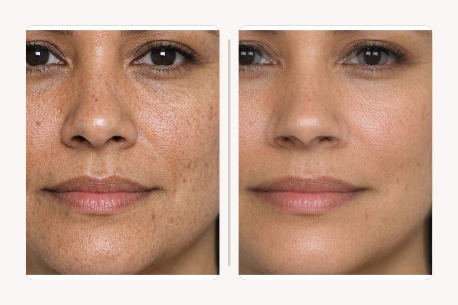 Illustrative small-area texture detail comparison for CO2 laser spot treatment