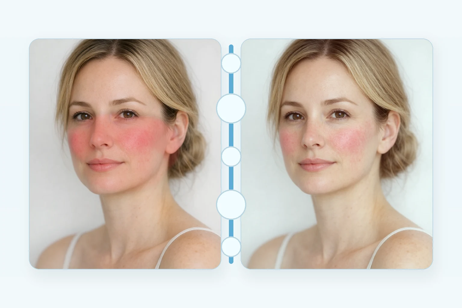 Illustrative before and after comparison for LED Light Therapy showing calmer skin and reduced redness